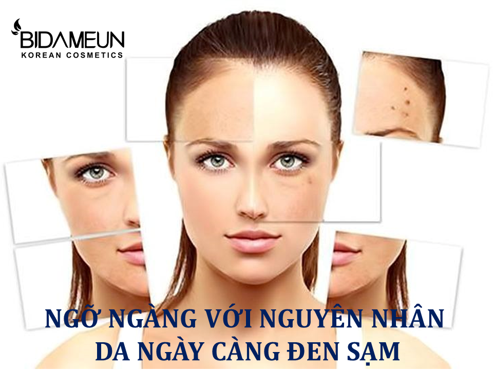 6 nguyên nhân hàng đầu khiến da mặt sạm và kém căng bóng