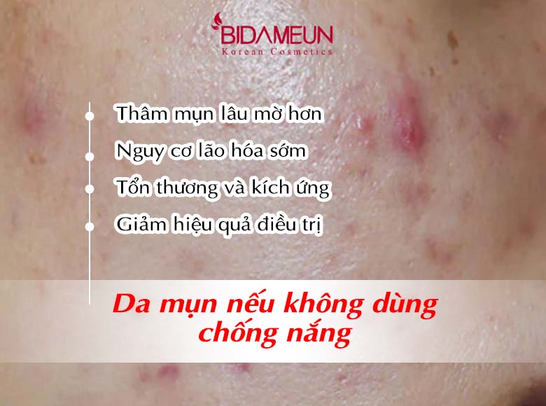 da-mun-co-nen-dung-kem-chong-nang-khong