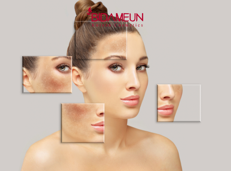  nguyen-nhan-duong-da-mat-mai-khong-trang