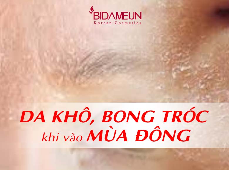 Da khô, bong tróc hơn khi vào mùa đông: Nguyên nhân và cách khắc phục