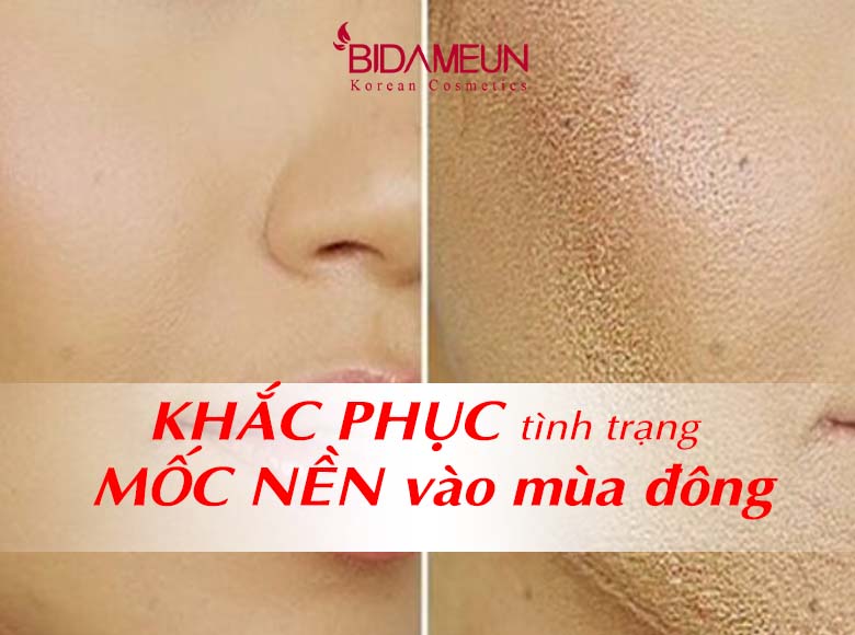 Khắc phục tình trạng mốc nền vào đông