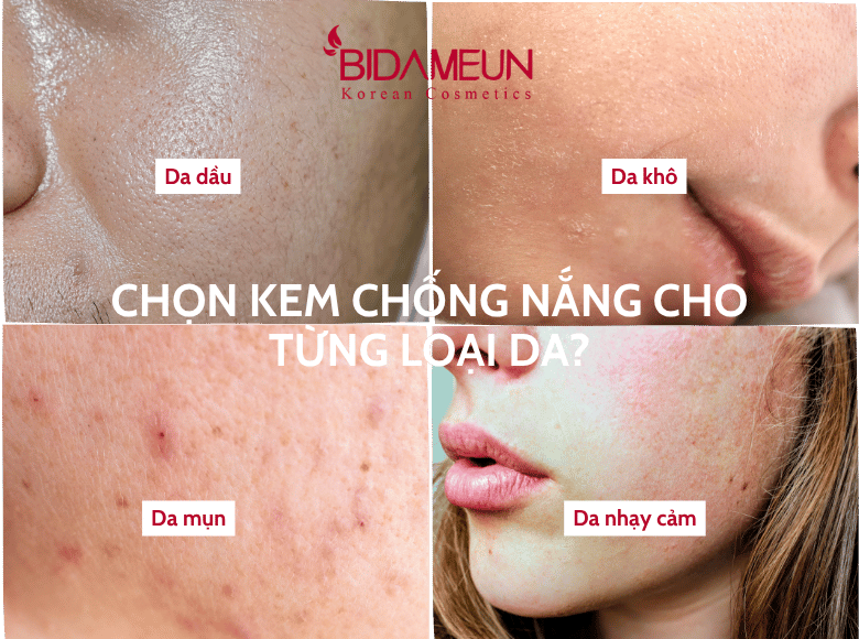 chi-so-spf-va-pa-cua-kem-chong-nang-la-gi?-cach-chon-spf-va-pa-phu-hop-cho-tung-loai-da