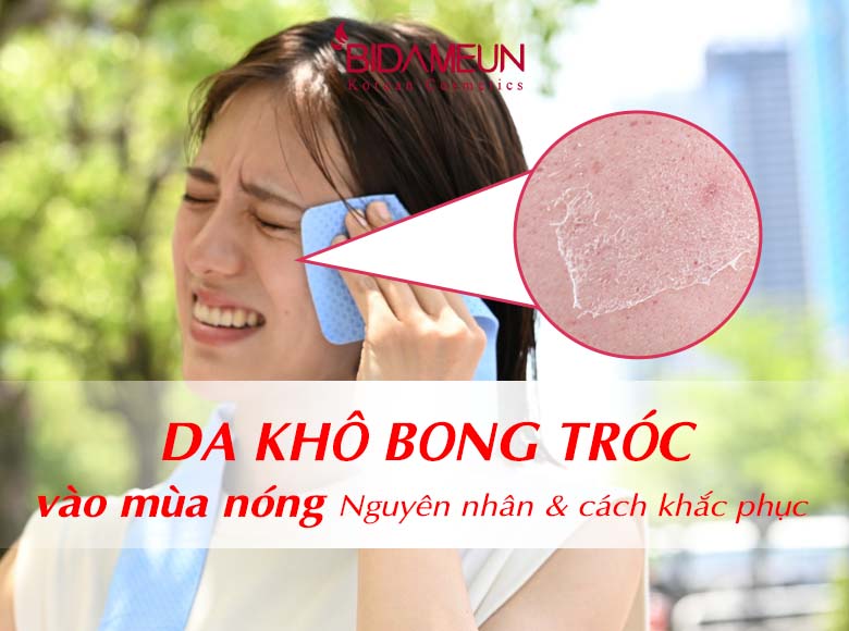 Da khô bong tróc vào mùa nóng: 5 nguyên nhân phổ biến & Cách khắc phục hiệu quả 