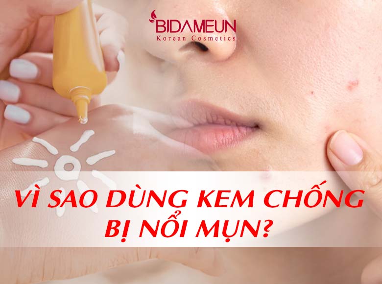 [GIẢI ĐÁP] Vì sao dùng kem chống nắng bị nổi mụn? Cách chọn kem chống nắng cho da dễ nổi mụn